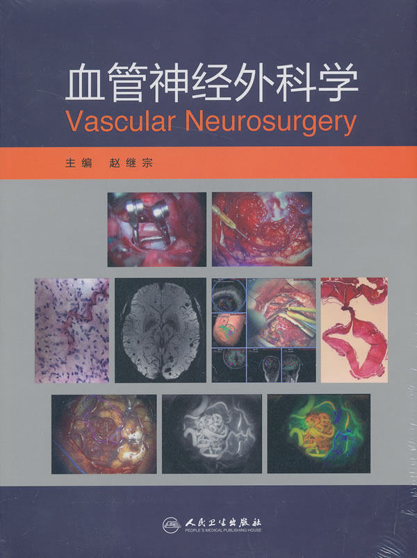 【特价清仓】血管神经外科学 赵继宗 人民卫生出版社