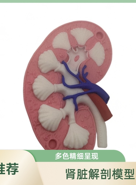 3D打印肾脏解剖模型多色成品