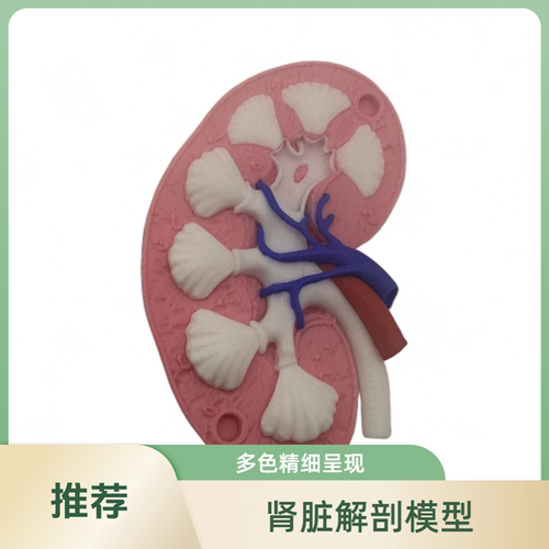 3D打印肾脏解剖模型多色成品