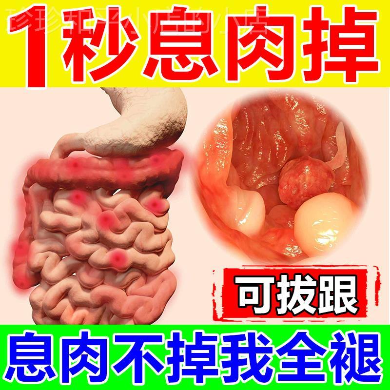 治疗肠息肉去除的药大便不成形次数多胃疼肠炎特效药中药肚脐贴