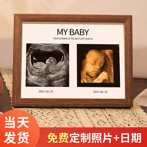 宝宝四维照片定制相框孕期nt b超彩超图打印婴儿记录摆台纪念相册