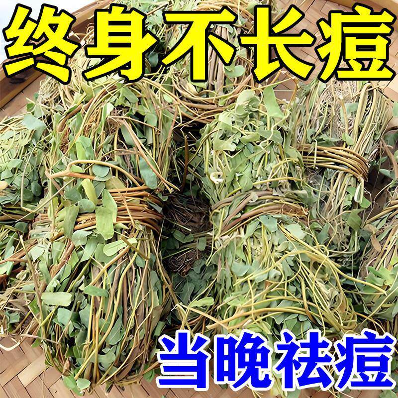 祛痘茶排毒痘痘内分泌调理清热解毒消炎去火中药去青春痘的三花茶