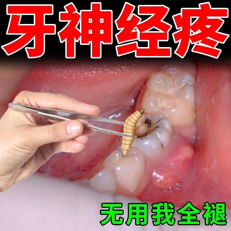 杀死牙神经去牙疼牙痛立可停治速口鼻清洁杀菌消炎剂