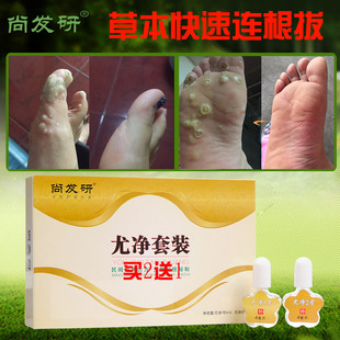 尚发研尤净跖疣专用膏去除祛寻常疣病毒疣瘊净鸡眼膏足部脚趾跖疣