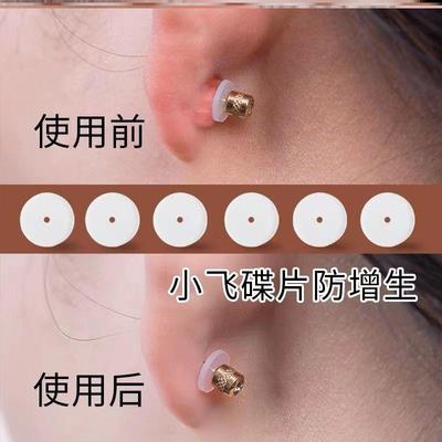 小飞碟脐钉耳堵酒窝硅胶软蜗钉软垫片耳骨养耳洞小飞碟防增生耳钉