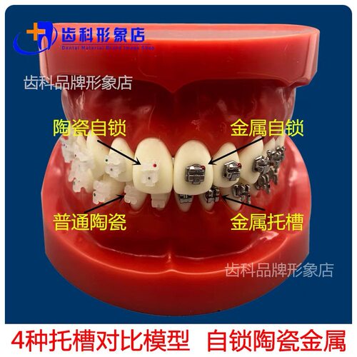 牙科口腔 4种托槽对比模型正畸陶瓷金属自锁托槽托槽示范模型包邮