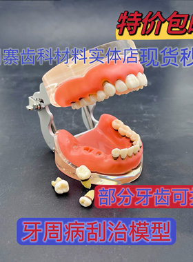 牙科口腔牙周并理模型 练习龈下牙结石刮治 牙周刮治模型4017包邮
