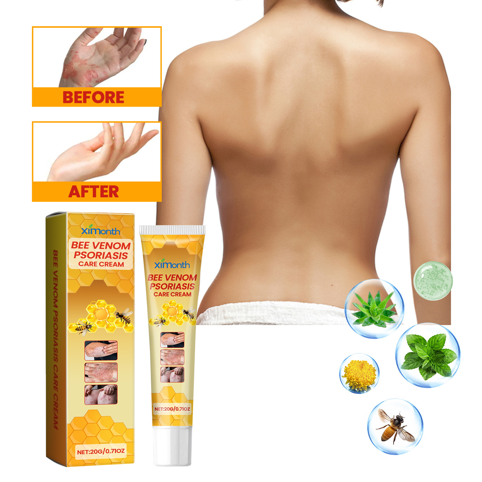 Ximonth蜂毒牛皮藓膏缓解皮肤