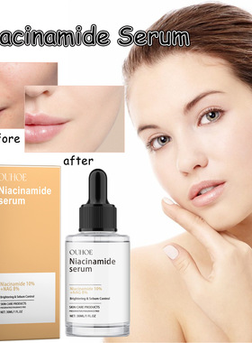 Niacinamide Serum Soften, Smooth and Brighten Skin Hydrate,