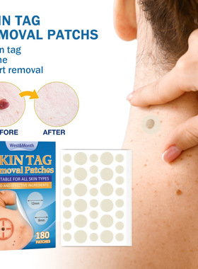 Ke you tie ke you tie Chu rou ke you flat especially wart an