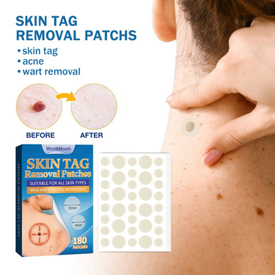 克疣贴除肉粒克疣扁平尤疣瘊