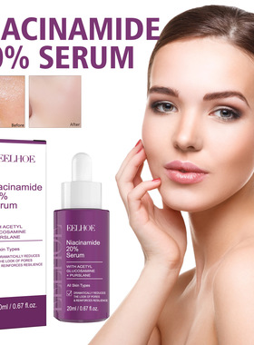 Niacinamide Firming Serum Facial Skin Care Lift Fades Blemis