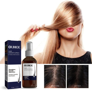 Hair Growth Spray Strengthening Hair Dense Hair Moisturising
