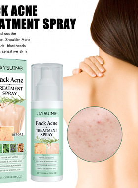 Back care spray soothes back skin replenishes water cleans m