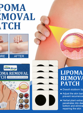 Fat knot repair patch for relieving subcutaneous lump and re