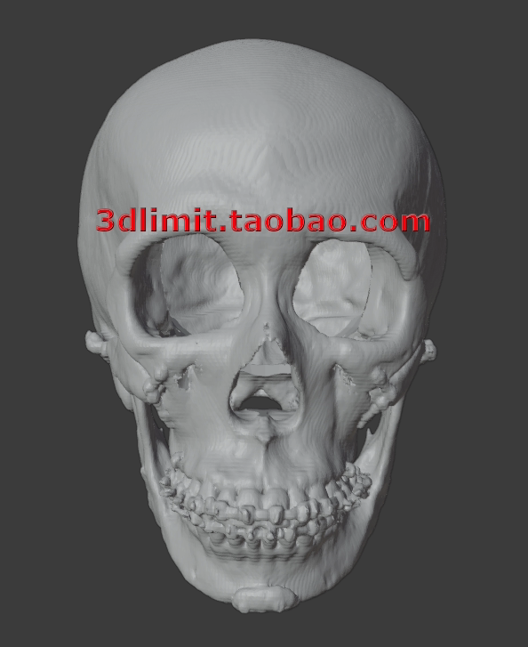 医学3D打印扫描DICOM dcm CT数据转换3D模型stl obj G代码Gcode