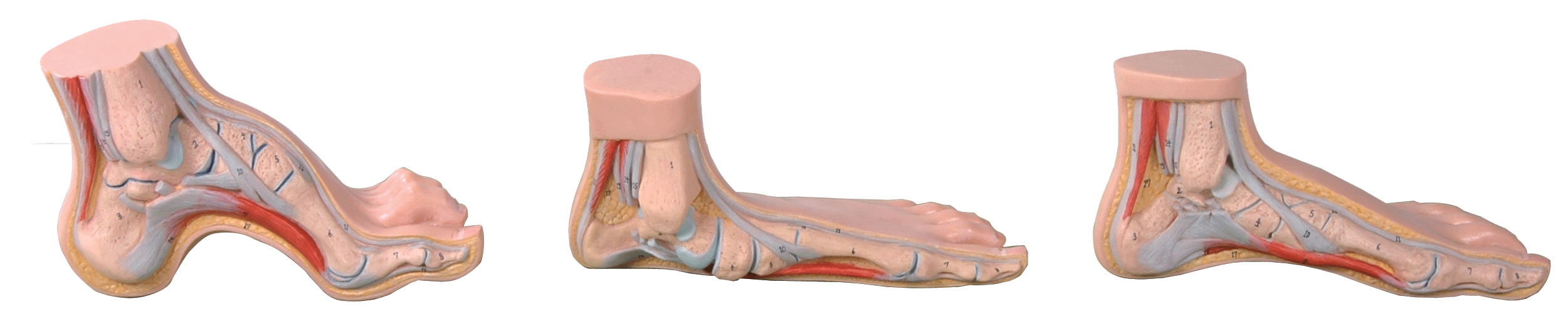 正常足,扁平足,弓形足模型a11310