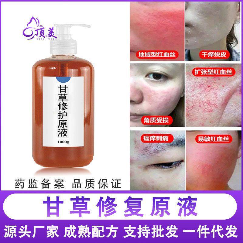 去泛敏感激素修护红脸精华收缩毛孔角质层原液脸甘草修复补水保湿