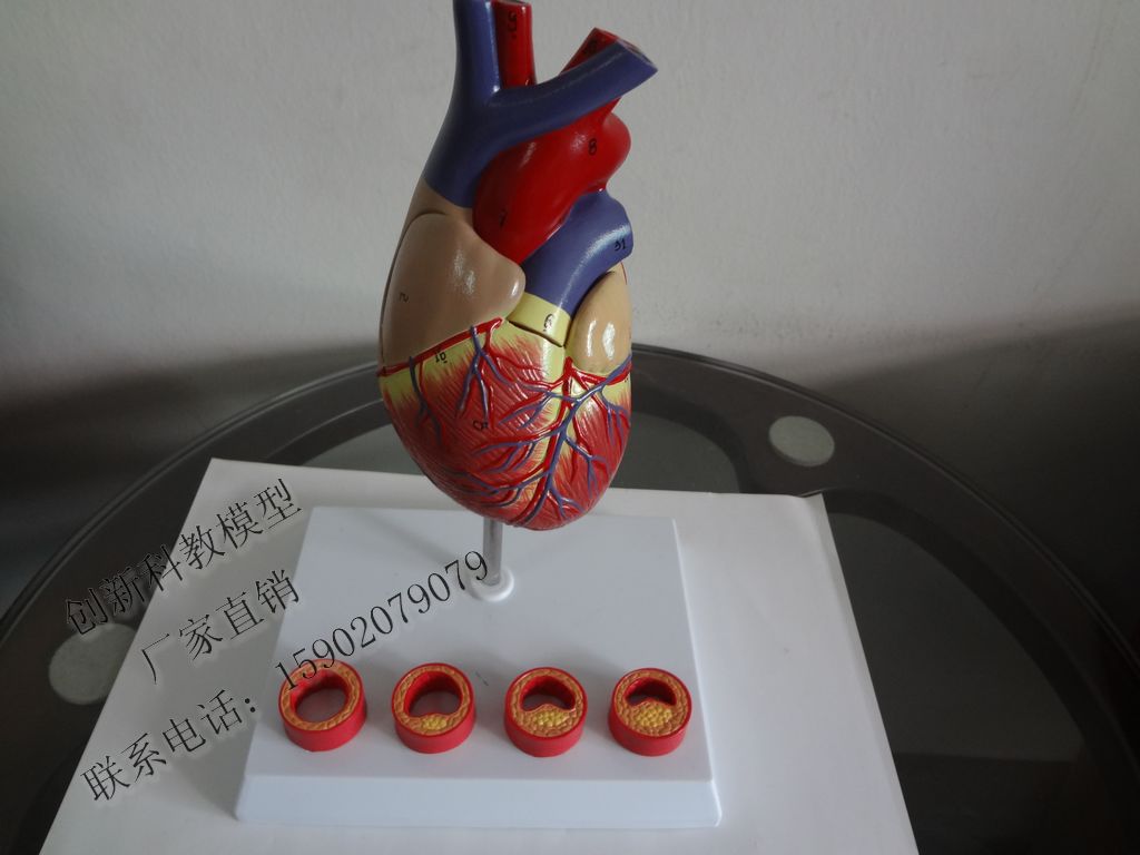 进口精品  豪华心脏 自然大 带4阶段血管 解剖模型 教学医用