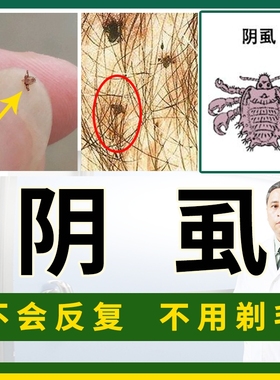 阴虱药男士用女私处去虱子药一扫光除虱卵净虱灵百部酊灭阴虱喷剂