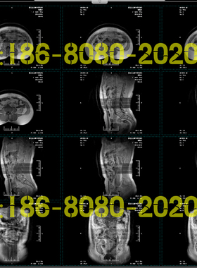 CT工作站软件X光机CR软件DR工作站MRI核磁软件DSA软件PACS软件