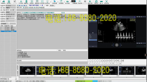 超声高清软件B超软件彩超高清版软件超声影像高清软件win7/win10