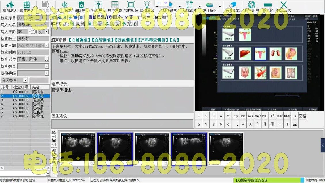 超声工作站软件黑白B超彩超软件+视频采集卡+连接线脚踏全套包邮