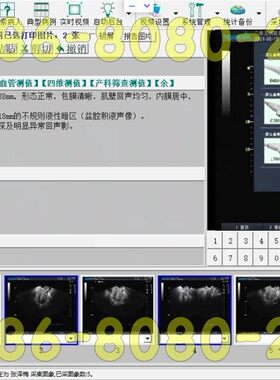超声工作站软件黑白B超彩超软件+视频采集卡+连接线脚踏全套包邮