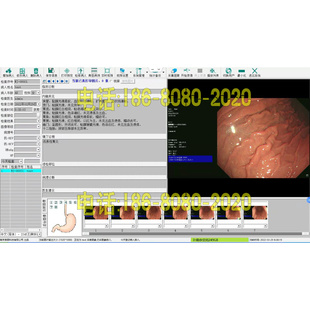 胃镜肠镜软件安装标清高清采集卡加配件整套内镜内窥镜工作站软件
