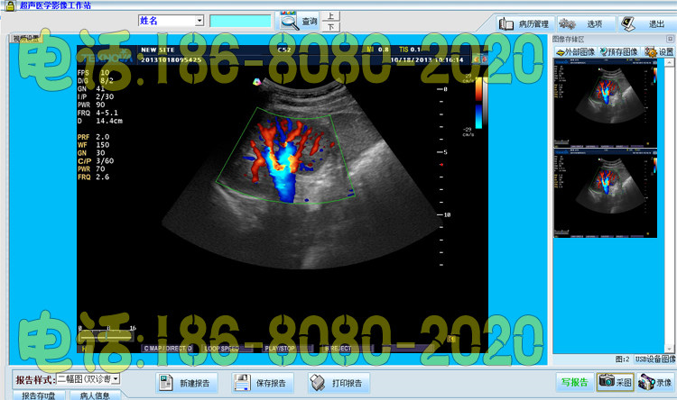 B超软件B超报告彩超软件四维彩超软件超声影像软件win7/win