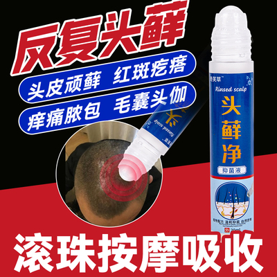 头皮油脂瘙痒泛红脱皮结痂红斑
