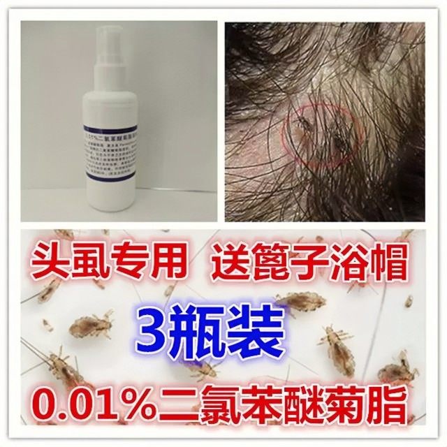 3瓶 虱子药儿童去头虱一扫光送篦子浴帽0.01二氯苯醚菊脂酯虱溶液