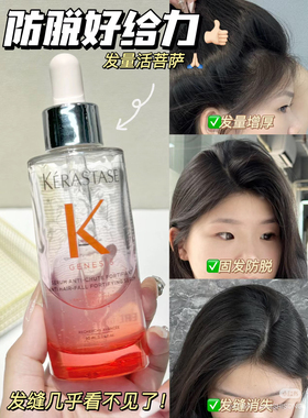 卡诗元气姜防脱精华控油头皮修护精华液90ml 28.7