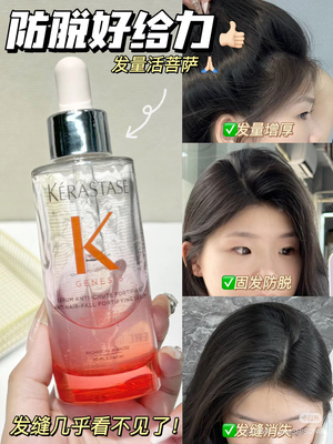 临期特价 卡诗元气姜防脱精华控油固发头皮修护精华液 90ml 27.1