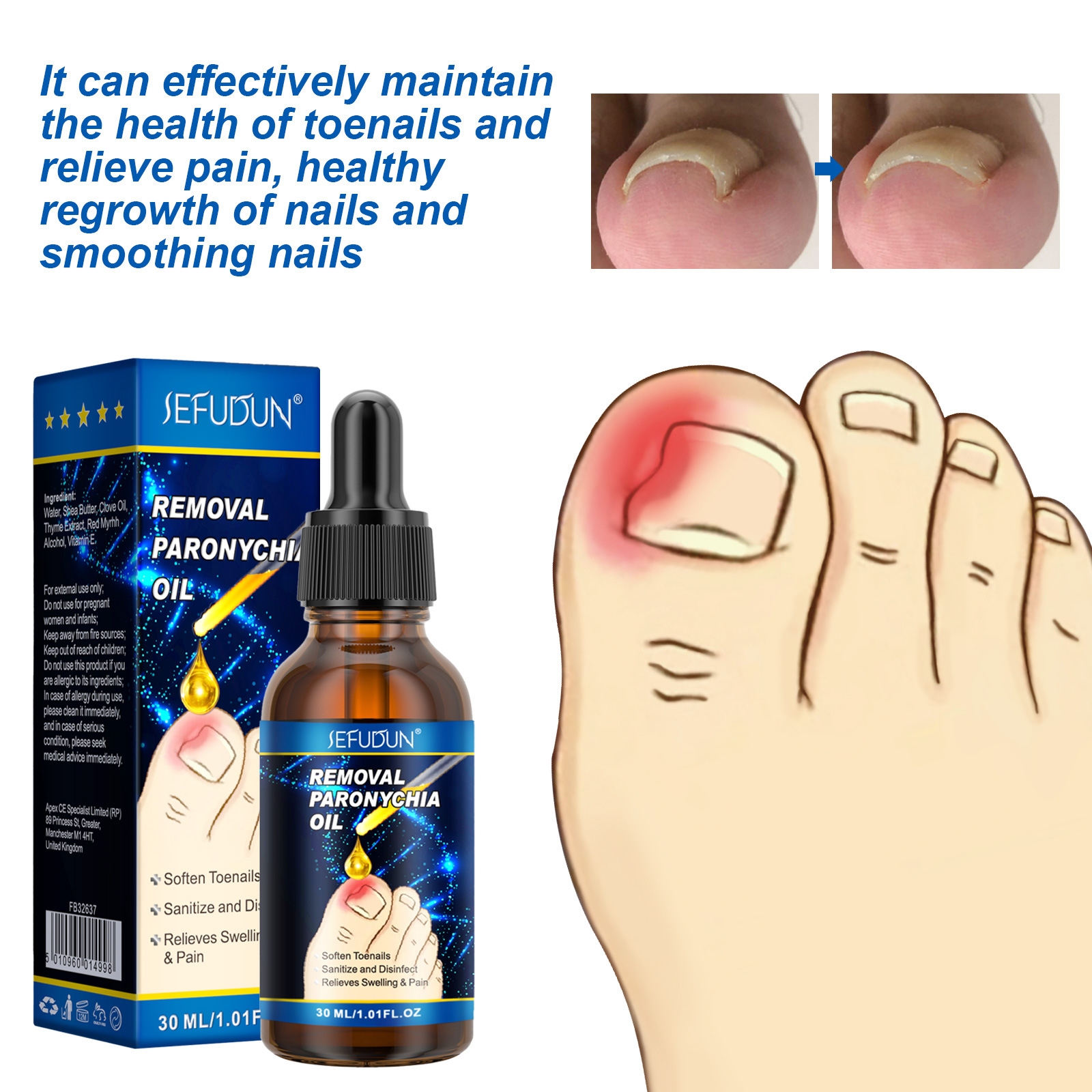 甲沟甲嵌抗甲软甲修护液灰指甲