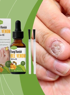 Nail Care Oil Gentle Repair Soft Nails Thick Nails Ingrown N