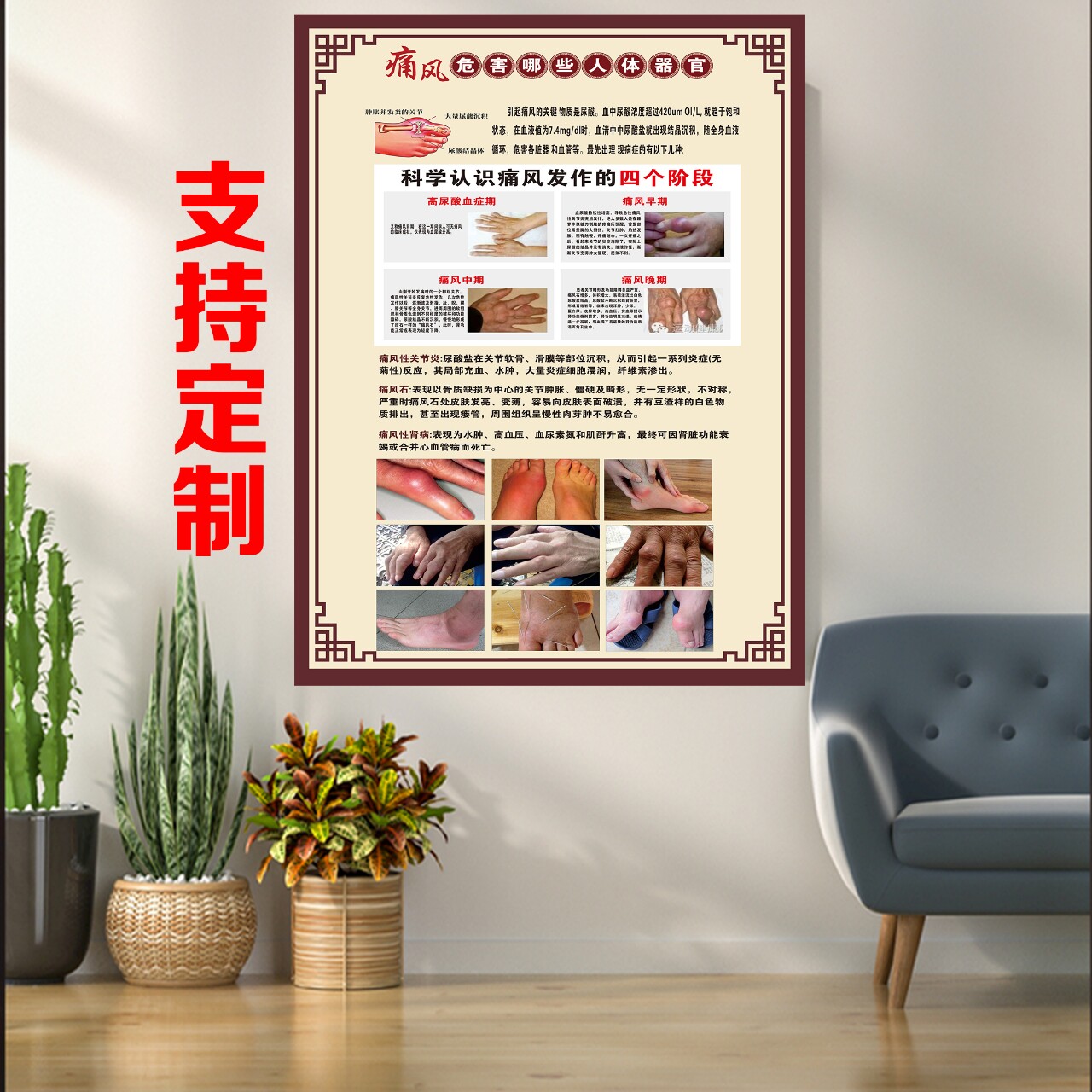 中医养生馆美容院痛风的病因症状写真/海报印制