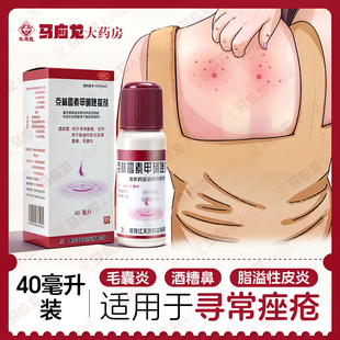 包邮】天龙 克林霉素甲硝唑搽剂 40ml*1瓶痤疮脂溢性皮炎 酒渣鼻