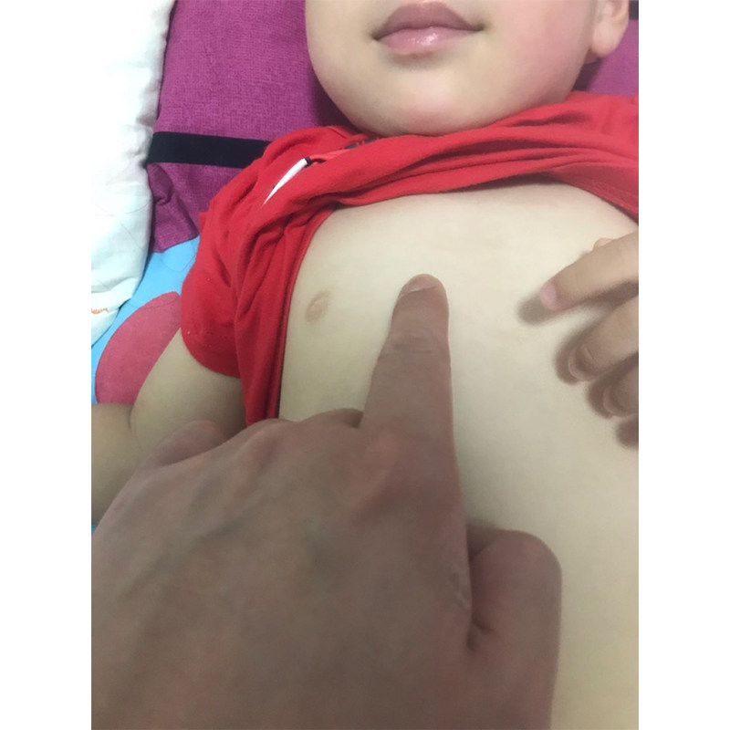 儿童肋骨护胸带腹带婴幼儿男女宝宝