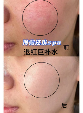 厚脸皮光感莹润面膜 项目后可用 第四代冰凝膜布高纯蓝铜肽强修护