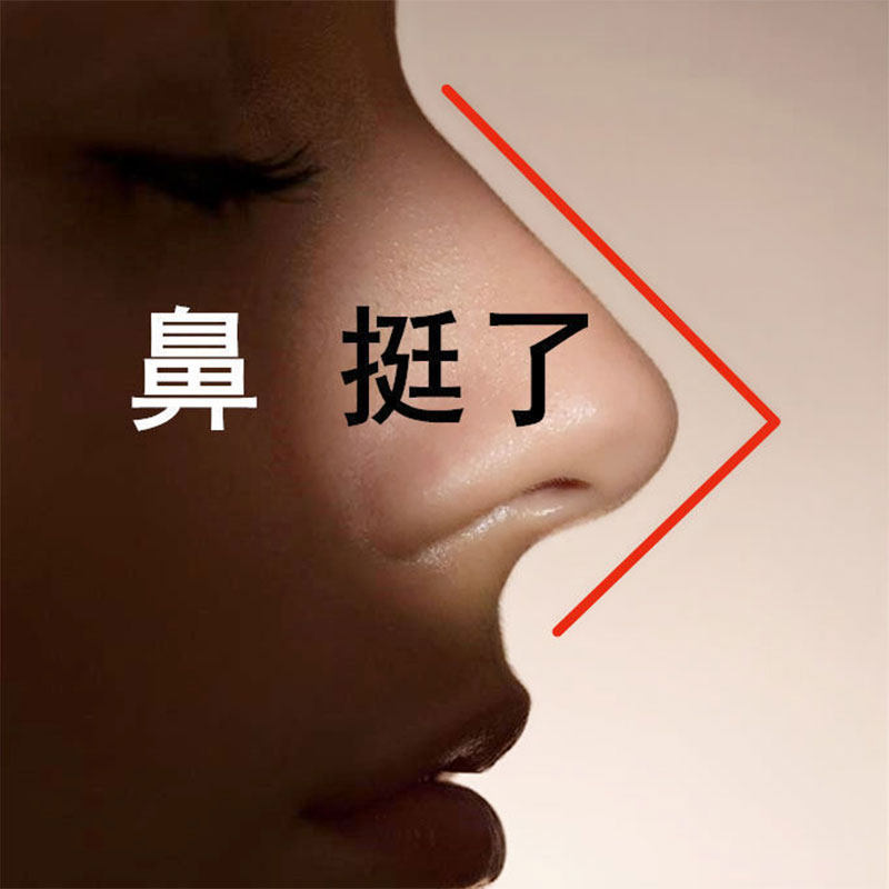 学生美鼻神器高鼻梁山根挺鼻精华油瘦鼻头矮塌鼻鼻子变挺缩小鼻翼