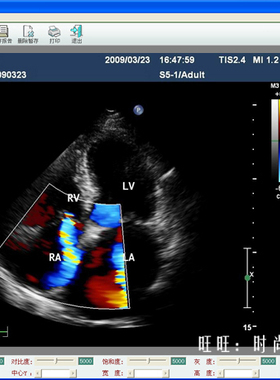 高清超声工作站软件 彩超工作站软件 VGA DVI HDMI SDI DP 接口
