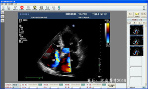 高清超声工作站软件彩超超声HDMI