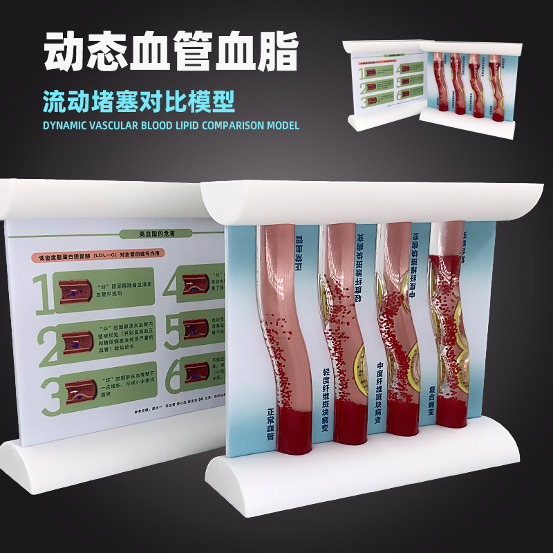 动态血管堵塞血管堵塞教学模型