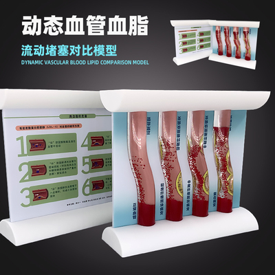 动态血管堵塞血管堵塞教学模型