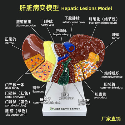 人体高度仿真肝脏解剖模型肝胆胰脾十二指肠病变器官结构教学模型