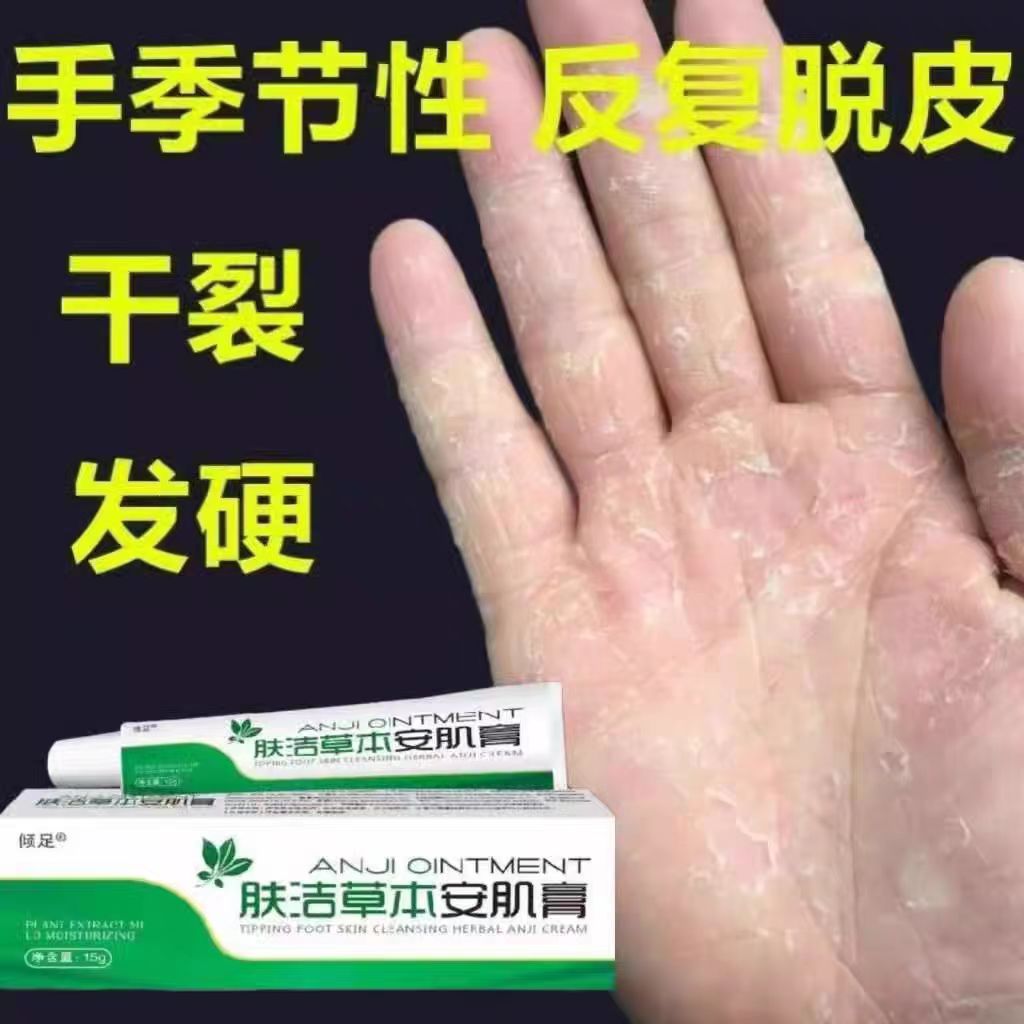 肤洁草本安肌膏手足脱皮抑菌膏脚底脱皮手上起皮干燥防手裂用倾足