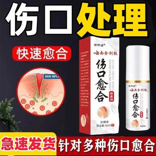 云南金创散伤口愈合喷剂炎消粉摔伤刀伤烫伤压创止血生肌烧快速