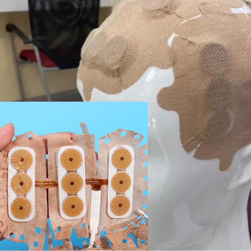 TTFields肿瘤治疗电极片