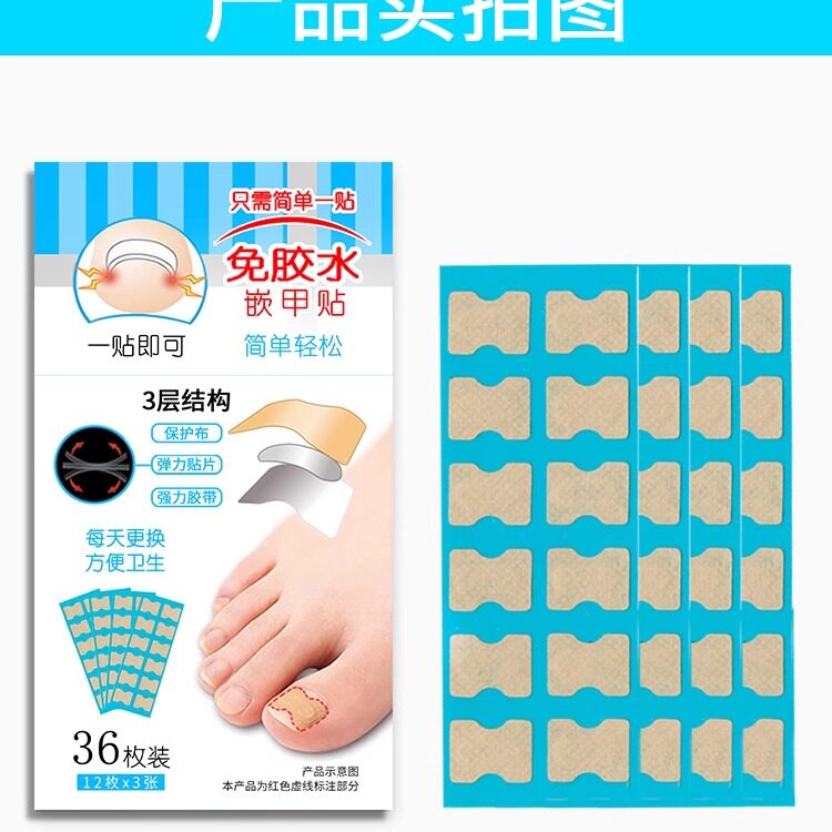 免胶水正甲贴脚趾甲甲沟嵌甲专用美甲/修甲套装